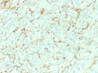 Formalin-fixed, paraffin-embedded human Adrenal Gland stained with NGFR Mouse Monoclonal Antibody (NGFR/1964).