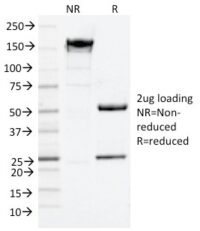 SDS-PAGE Analysis Purified NGFR Mouse Monoclonal Antibody (NGFR/1964).Confirmation of Purity and Integrity of Antibody.