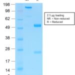 SDS-PAGE Analysis Purified NGFR Rabbit Recombinant Monoclonal Antibody (NGFR/1997R).Confirmation of Purity and Integrity of Antibody.