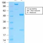 SDS-PAGE Analysis Purified NGFR Rabbit Recombinant Monoclonal Antibody (NGFR/1997R).Confirmation of Purity and Integrity of Antibody.