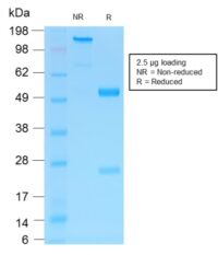 SDS-PAGE Analysis Purified NGFR Rabbit Recombinant Monoclonal Antibody (NGFR/1997R).Confirmation of Purity and Integrity of Antibody.