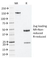 SDS-PAGE Analysis Purified Nucleophosmin Mouse Monoclonal Antibody (NA24).Confirmation of Integrity and Purity of Antibody.