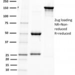 SDS-PAGE Analysis  Purified PAX5 Mouse Monoclonal Antibody (PAX5/2595).Confirmation of Purity and Integrity