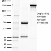 SDS-PAGE Analysis  Purified PAX5 Mouse Monoclonal Antibody (PAX5/2595).Confirmation of Purity and Integrity