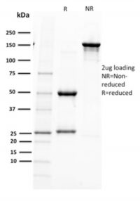 SDS-PAGE Analysis  Purified PAX5 Mouse Monoclonal Antibody (PAX5/2595).Confirmation of Purity and Integrity