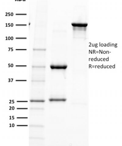 SDS-PAGE Analysis  Purified PAX5 Mouse Monoclonal Antibody (PAX5/2595).Confirmation of Purity and Integrity