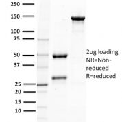 SDS-PAGE Analysis Purified PTEN Mouse Monoclonal Antibody (PTEN/2110).Confirmation of Purity and Integrity of Antibody.