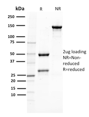 SDS-PAGE Analysis Purified PTEN Mouse Monoclonal Antibody (PTEN/2110).Confirmation of Purity and Integrity of Antibody.
