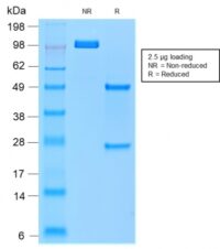 SDS-PAGE Analysis of Purified TRAcP Mouse Recombinant Monoclonal Antibody (rACP5/1070).Confirmation of Purity and Integrity of Antibody.