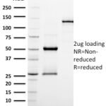 SDS-PAGE Analysis Purified EGFR Mouse Monoclonal Antibody (GFR/2596).Confirmation of Integrity and Purity of Antibody.