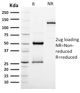SDS-PAGE Analysis Purified EGFR Mouse Monoclonal Antibody (GFR/2596).Confirmation of Integrity and Purity of Antibody.