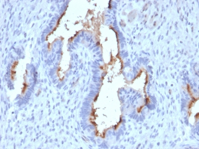 Formalin-fixed, paraffin-embedded human Endometrium stained with Podocalyxin Mouse Monoclonal Antibody (PODXL/2185).