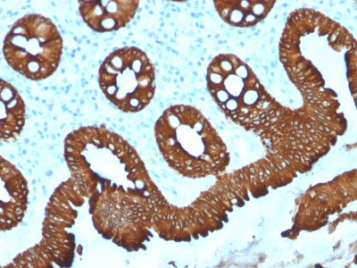 Formalin-fixed, paraffin-embedded human Colon stained with Cytokeratin 20 (KRT20) Mouse Monoclonal Antibody (KRT20/1992).
