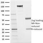 SDS-PAGE Analysis Purified BOB1 Mouse Monoclonal Antibody (BOB1/2424).Confirmation of purity and integrity.