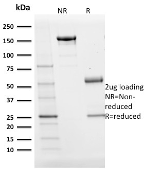 SDS-PAGE Analysis Purified BOB1 Mouse Monoclonal Antibody (BOB1/2424).Confirmation of purity and integrity.