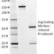 SDS-PAGE Analysis Purified BOB1 Mouse Monoclonal Antibody (BOB1/2425).Confirmation of Integrity and Purity of Antibody.
