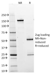 SDS-PAGE Analysis Purified BOB1 Mouse Monoclonal Antibody (BOB1/2425).Confirmation of Integrity and Purity of Antibody.