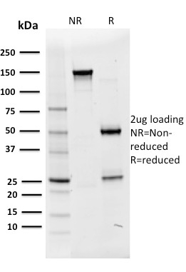 SDS-PAGE Analysis Purified Oct-2 Mouse Monoclonal Antibody (OCT2/2136).Confirmation of Purity and Integrity.