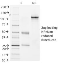 SDS-PAGE Analysis Purified BCL-6 Mouse Monoclonal Antibody (BCL6/1982).Confirmation of Integrity and Purity of Antibody.