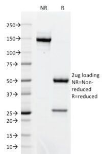 SDS-PAGE Analysis Purified BCL-6 Mouse Monoclonal Antibody (BCL6/1718).Confirmation of Integrity and Purity of Antibody.