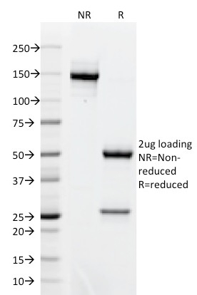 SDS-PAGE Analysis Purified BCL-6 Mouse Monoclonal Antibody (BCL6/1718).Confirmation of Integrity and Purity of Antibody.