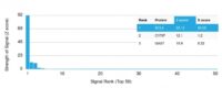 Analysis of Protein Array containing more than 19,000 full-length human proteins using Bcl-6 Rabbit Monoclonal Antibody (BCL6/1951R) Z- and S- Score: The Z-score represents the strength of a signal that a monoclonal antibody (MAb) (in combination with a fluorescently-tagged anti-IgG secondary antibody) produces when binding to a particular protein on the HuProtTM array. Z-scores are described in units of standard deviations (SDs) above the mean value of all signals generated on that array. If targets on HuProtTM are arranged in descending order of the Z-score, the S-score is the difference (also in units of SDs) between the Z-score. S-score therefore represents the relative target specificity of a MAb to its intended target.  A MAb is considered to specific to its intended target, if the MAb has an S-score of at least 2.5. For example, if a MAb binds to protein X with a Z-score of 43 and to protein Y with a Z-score of 14, then the S-score for the binding of that MAb to protein X is equal to 29.