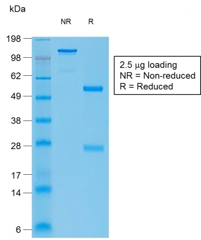 SDS-PAGE Analysis Purified bcl-6 Rabbit Recombinant Monoclonal Antibody (BCL6/1951R).Confirmation of Integrity and Purity of Antibody.