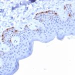 Formalin-fixed, paraffin-embedded human Skin stained with gp100 Mouse Monoclonal Antibody (PMEL/2037).