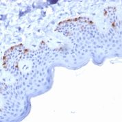 Formalin-fixed, paraffin-embedded human Skin stained with gp100 Mouse Monoclonal Antibody (PMEL/2037).