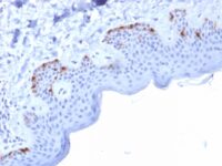 Formalin-fixed, paraffin-embedded human Skin stained with gp100 Mouse Monoclonal Antibody (PMEL/2037).