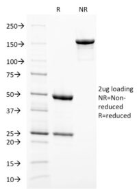 SDS-PAGE Analysis Purified gp100 Mouse Monoclonal Antibody (PMEL/2038).Confirmation of Integrity and Purity of Antibody.