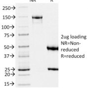 SDS-PAGE Analysis Purified gp100 Mouse Monoclonal Antibody (PMEL/2039).Confirmation of Integrity and Purity of Antibody.