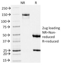 SDS-PAGE Analysis Purified gp100 Mouse Monoclonal Antibody (PMEL/2039).Confirmation of Integrity and Purity of Antibody.