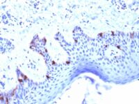 Formalin-fixed, paraffin-embedded human Skin stained with gp100 Mouse Monoclonal Antibody (PMEL/2039).