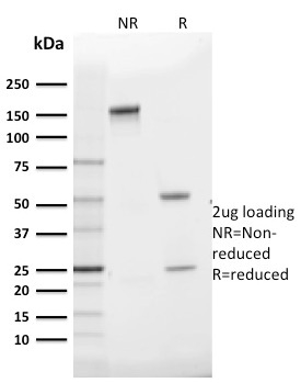 SDS-PAGE Analysis Purified GLUT-1 Mouse Monoclonal Antibody (GLUT1/2475).Confirmation of Purity and Integrity of Antibody.
