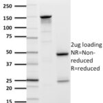 SDS-PAGE Analysis Purified GLUT-1 Mouse Monoclonal Antibody (GLUT1/2476).Confirmation of Purity and Integrity of Antibody.