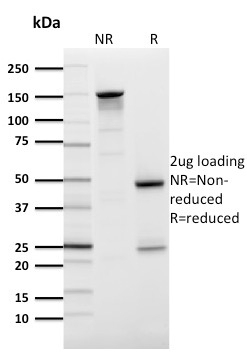 SDS-PAGE Analysis Purified GLUT-1 Mouse Monoclonal Antibody (GLUT1/2476).Confirmation of Purity and Integrity of Antibody.