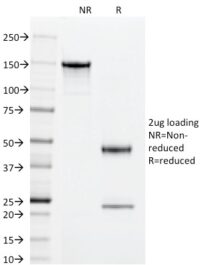 SDS-PAGE Analysis Purified Superoxide Dismutase 1 Mouse Monoclonal Antibody (SOD1/2089).Confirmation of Integrity and Purity of Antibody.