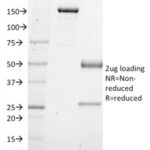 SDS-PAGE Analysis Purified SOX4 Mouse Monoclonal Antibody (SOX4/2540).Confirmation of Integrity and Purity of Antibody.