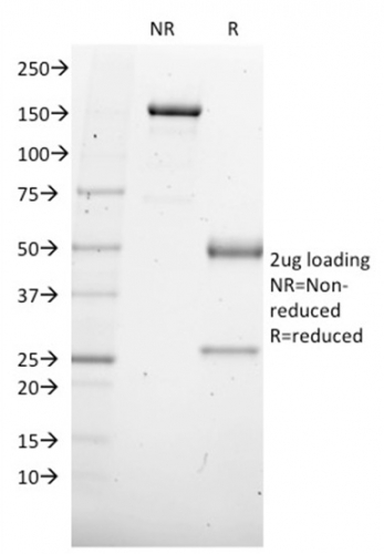 SDS-PAGE Analysis Purified SOX4 Mouse Monoclonal Antibody (SOX4/2540).Confirmation of Integrity and Purity of Antibody.