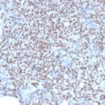 Formalin-fixed, paraffin-embedded human Lymph Node stained with PU.1 Mouse Monoclonal Antibody (PU1/2146).