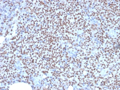 Formalin-fixed, paraffin-embedded human Lymph Node stained with PU.1 Mouse Monoclonal Antibody (PU1/2146).
