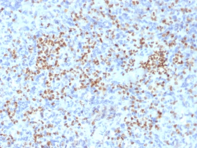 Formalin-fixed, paraffin-embedded human Spleen stained with PU.1 Mouse Monoclonal Antibody (PU1/2146).