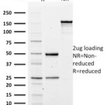 SDS PAGE Analysis of Purified Spectrin alpha 1 Mouse Monoclonal Antibody (SPTA1/1810).Confirmation of Purity and Integrity.