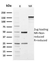 SDS PAGE Analysis of Purified Spectrin alpha 1 Mouse Monoclonal Antibody (SPTA1/1810).Confirmation of Purity and Integrity.