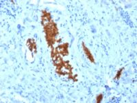 Formalin-fixed, paraffin-embedded Human Tonsil stained with Spectrin alpha 1 (SPTA1) Mouse Monoclonal Antibody (SPTA1/1810).