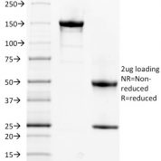 SDS-PAGE Analysis Purified Spectrin alpha 1 Mouse Monoclonal Antibody (SPTA1/1832).Confirmation of Purity and Integrity of Antibody.