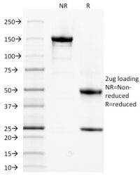 SDS-PAGE Analysis Purified Spectrin alpha 1 Mouse Monoclonal Antibody (SPTA1/1832).Confirmation of Purity and Integrity of Antibody.