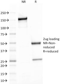 SDS-PAGE Analysis Purified Spectrin beta III Mouse Monoclonal Antibody (SPTBN2/1778).Confirmation of Integrity and Purity of Antibody.