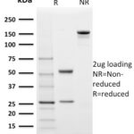 SDS-PAGE Analysis Purified StAR Mouse Monoclonal Antibody (STAR/2140).Confirmation of Integrity and Purity of Antibody.